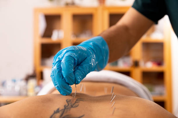 Dry Needling